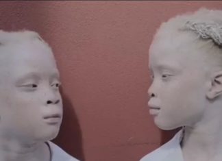 Find Out Why These Albino Twins Are Quickly Becoming Fashion Icons