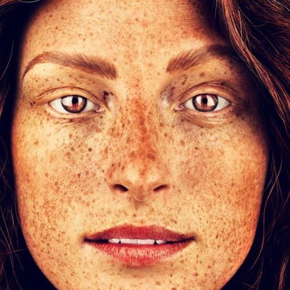 Photographer Shows the Stunning Beauty of Freckled People - TettyBetty