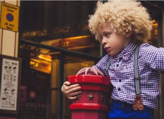 This 5-Year-Old Boy With Albinism Became a Model