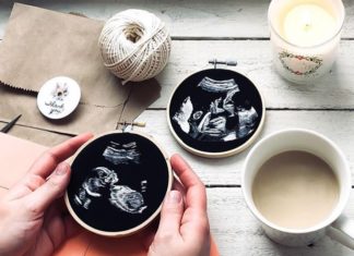 Artist Makes Custom Ultrasound Emroidery